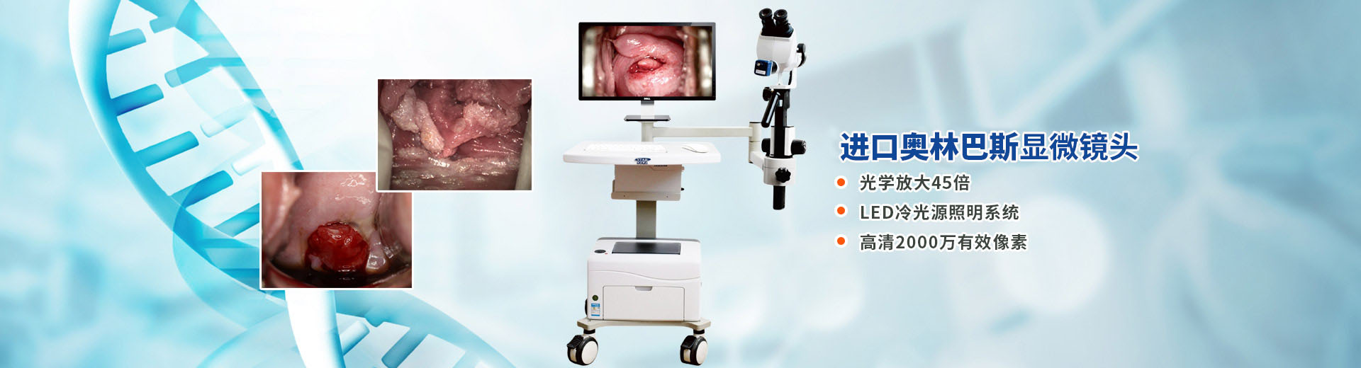 光學電子陰道鏡—電子陰道鏡—湖南恒星科技股份有限公司